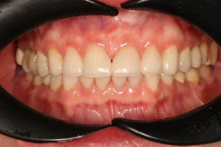 Ортопедическое лечение