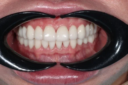 Ортопедическое лечение