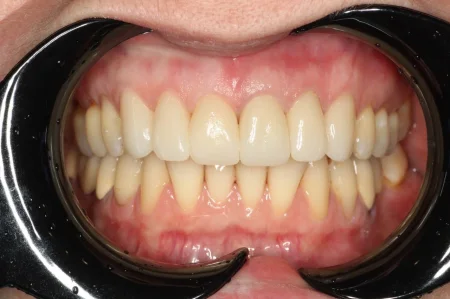 Ортопедическое лечение