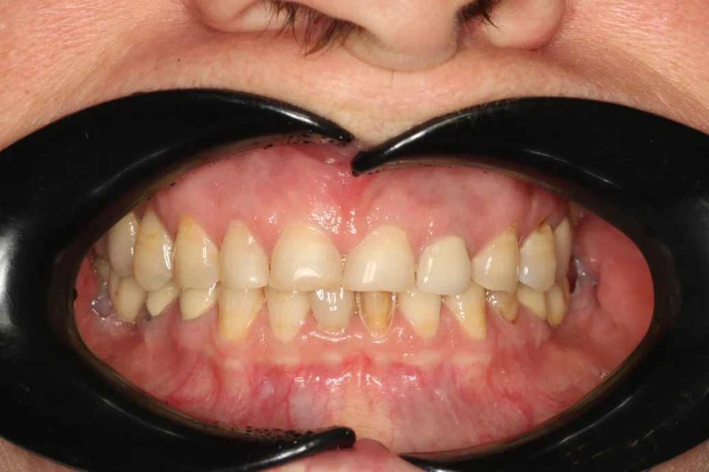 Работа до-после